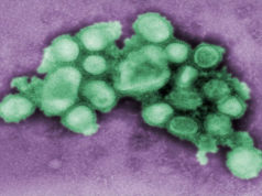 Is Influenza a deadly virus? Influenza