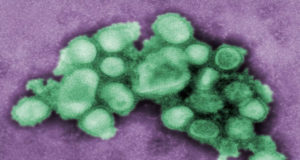 Is Influenza a deadly virus? Influenza